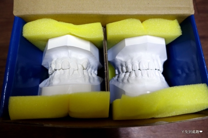 牙齒模型2
